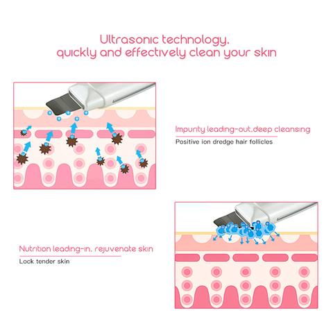 Ultrasonic Skin Scrubber Facial Cleanser